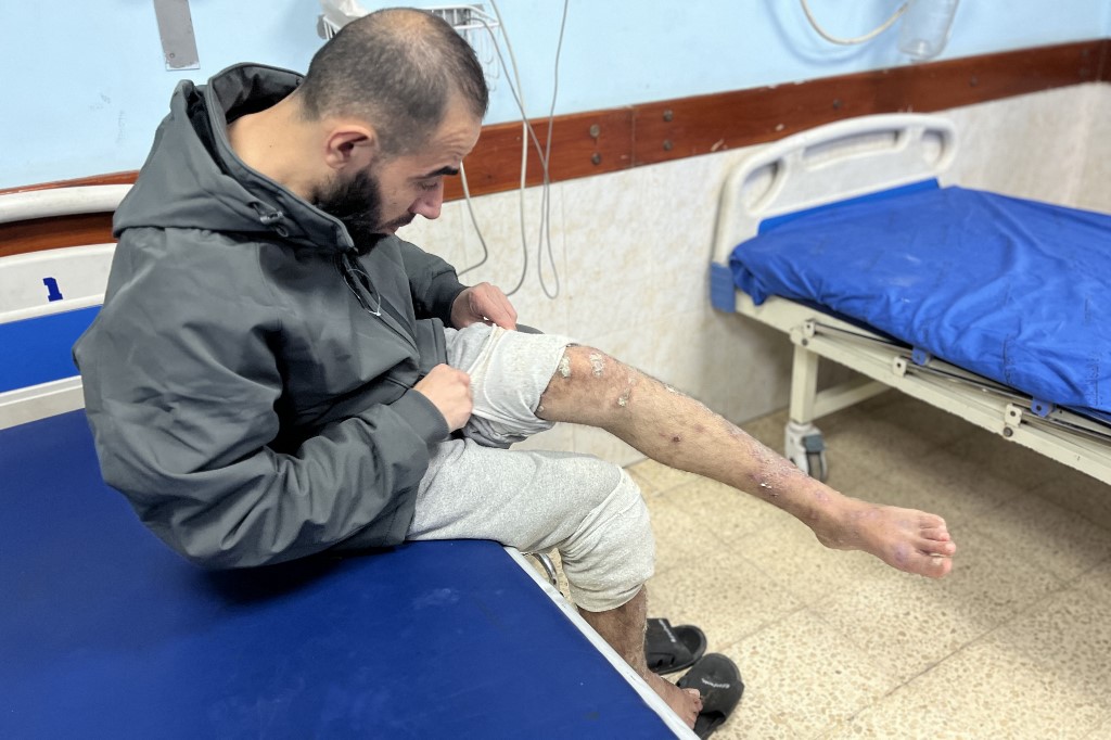 A Palestinian prisoner looks at his leg as he awaits treatment at the European Hospital in Khan Yunis in the southern Gaza Strip early on February 27, 2025, following his release by Israeli authorities. (AFP)
