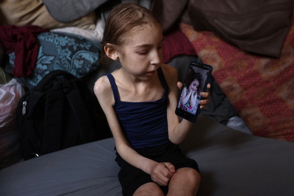 Rahaf Ayyad, a 12-year-old Palestinian who is suffering from malnutrition, shows off an old picture of her as she sits at a school-turned-shelter in al-Rimal in central Gaza City on May 4, 2025.