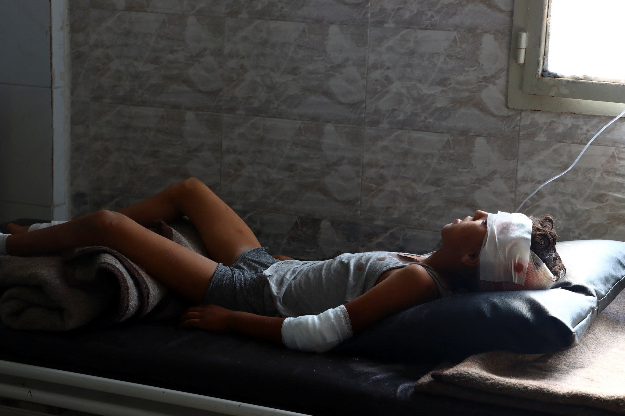 An injured child lies on a hospital bed following airstrikes on a countryside area, in Jisr al Shuqhur, Idlib province, Syria on 22 July 2022. (White Helmets via Reuters)