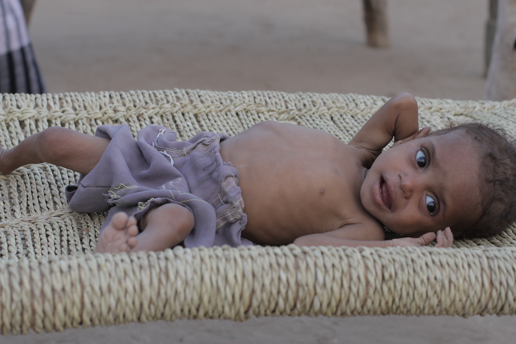 Ayyat, Khalid Hasan's malnourished daughter (MEE)