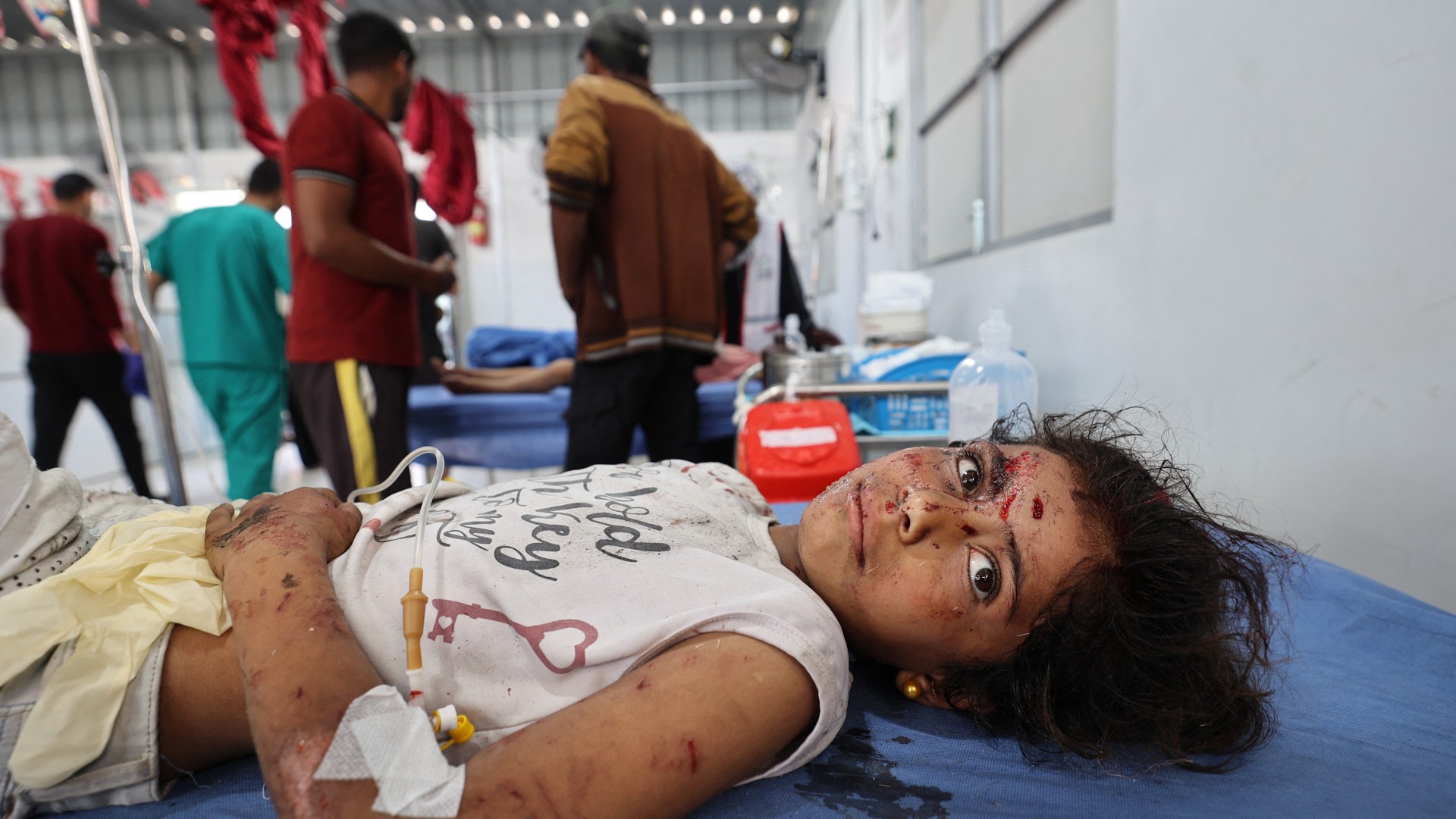 A wounded girl receives treatment at Al-Awda Hospital at the Nuseirat refugee camp in the central Gaza Strip, following an Israeli airstrike that hit a school in the camp on May 19, 2025
