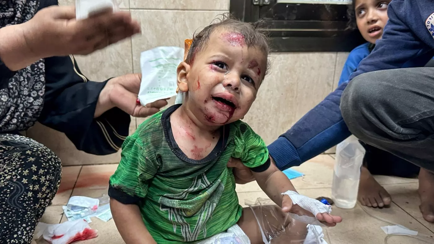 injured child Al Aqsa