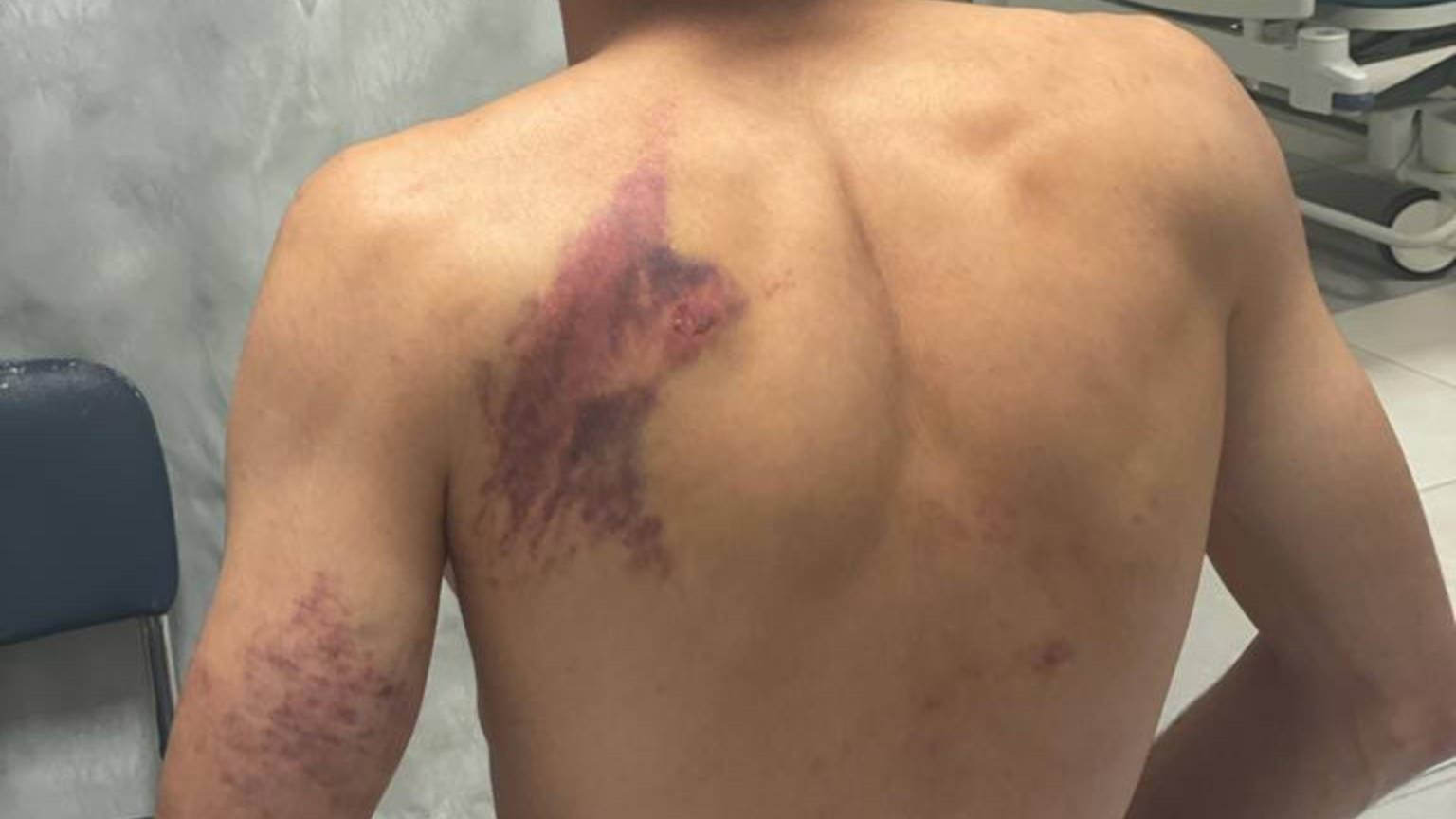 Former Palestinian prisoner Louay Ghaith suffered severe beating in al-Mascobiya prison (supplied)