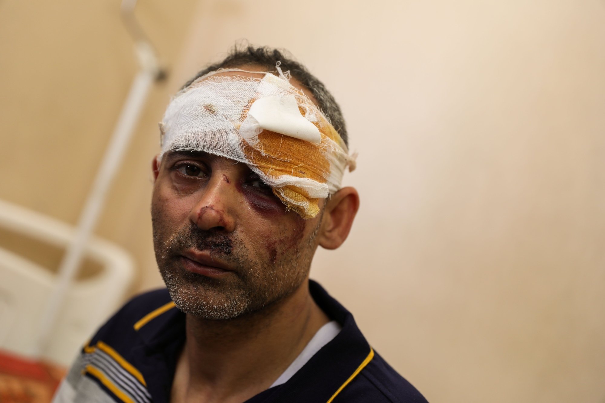 « Ce que j’ai perdu n’est rien par rapport à ce que mon peuple perd », assure Eshkuntana à Middle East Eye (MEE/Mohammed al-Hajjar)