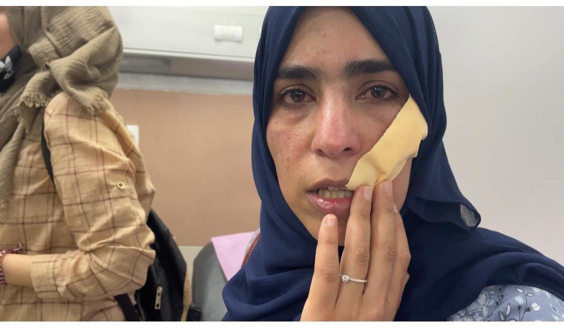 Palestinian female journalists attacked by PA forces