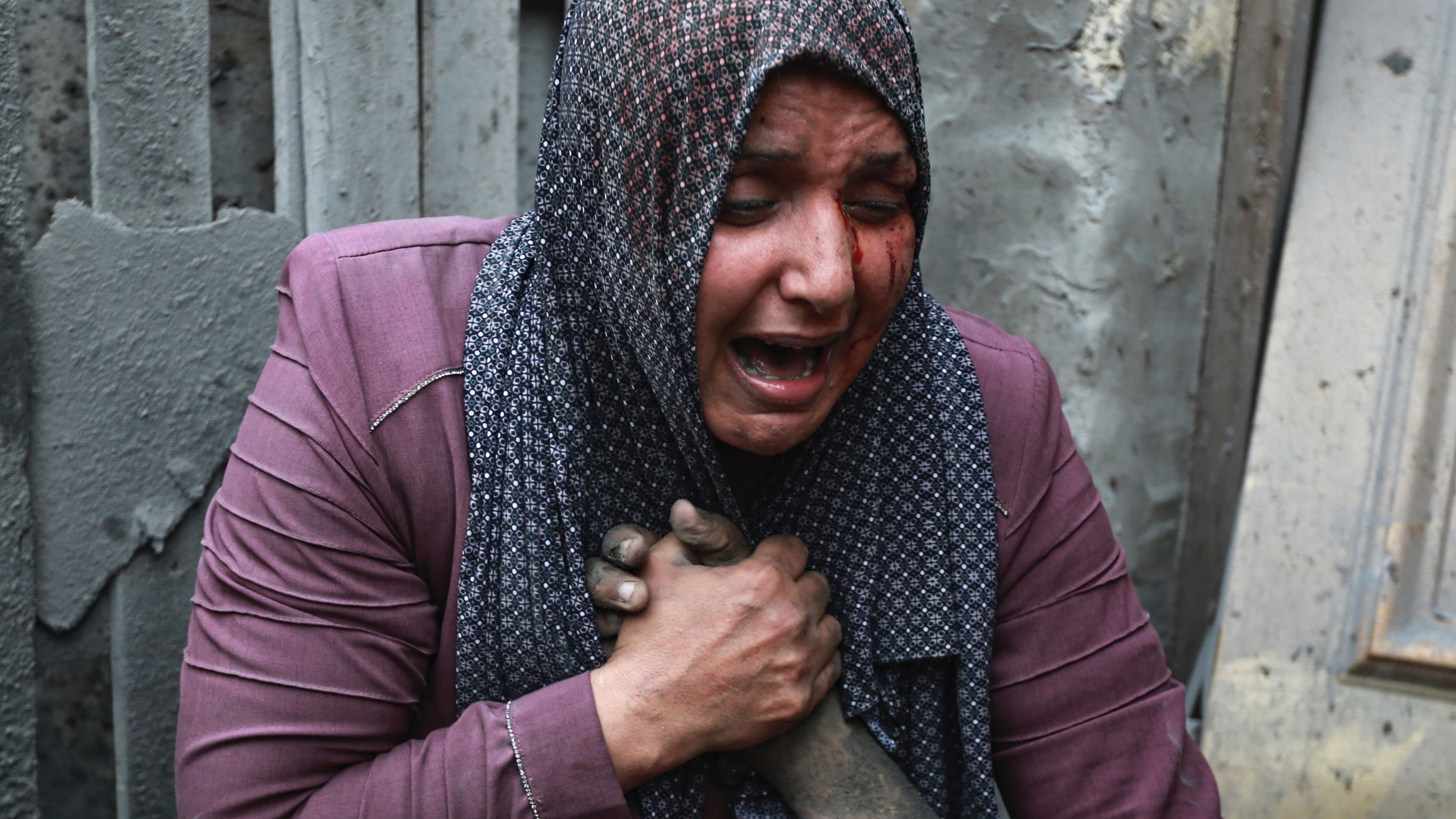A wounded Palestinian woman cries as she holds the hand of her dead relative outside her home following Israeli airstrikes that targeted their neighbourhood in Gaza City, Monday, Oct. 23, 2023. (AP Photo/Abed Khaled)