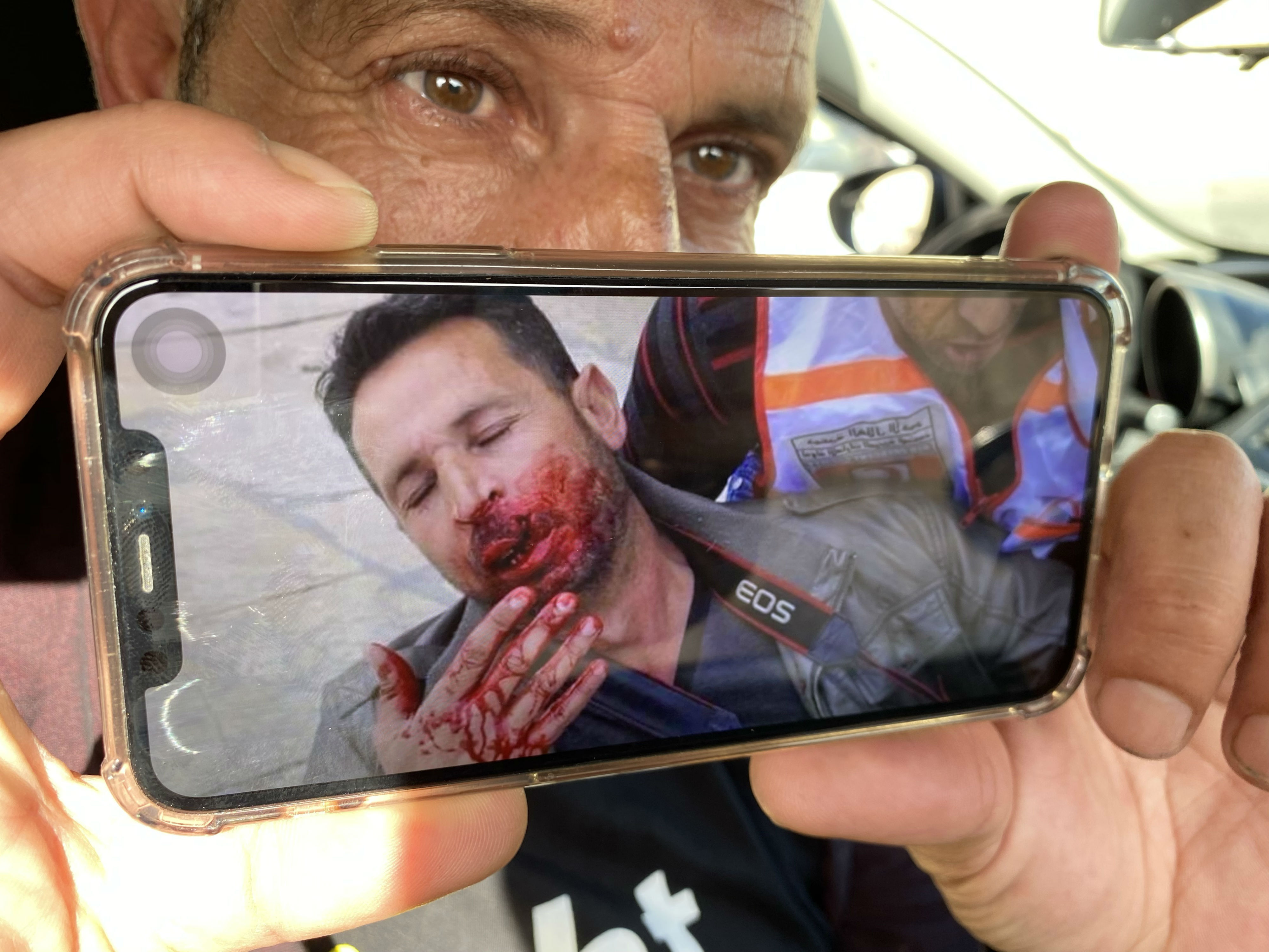 After he was hit, Owaisat momentarily lost consciousness but was soon awakened to kicks and insults before losing consciousness again (MEE/Juman Abu Arafeh)