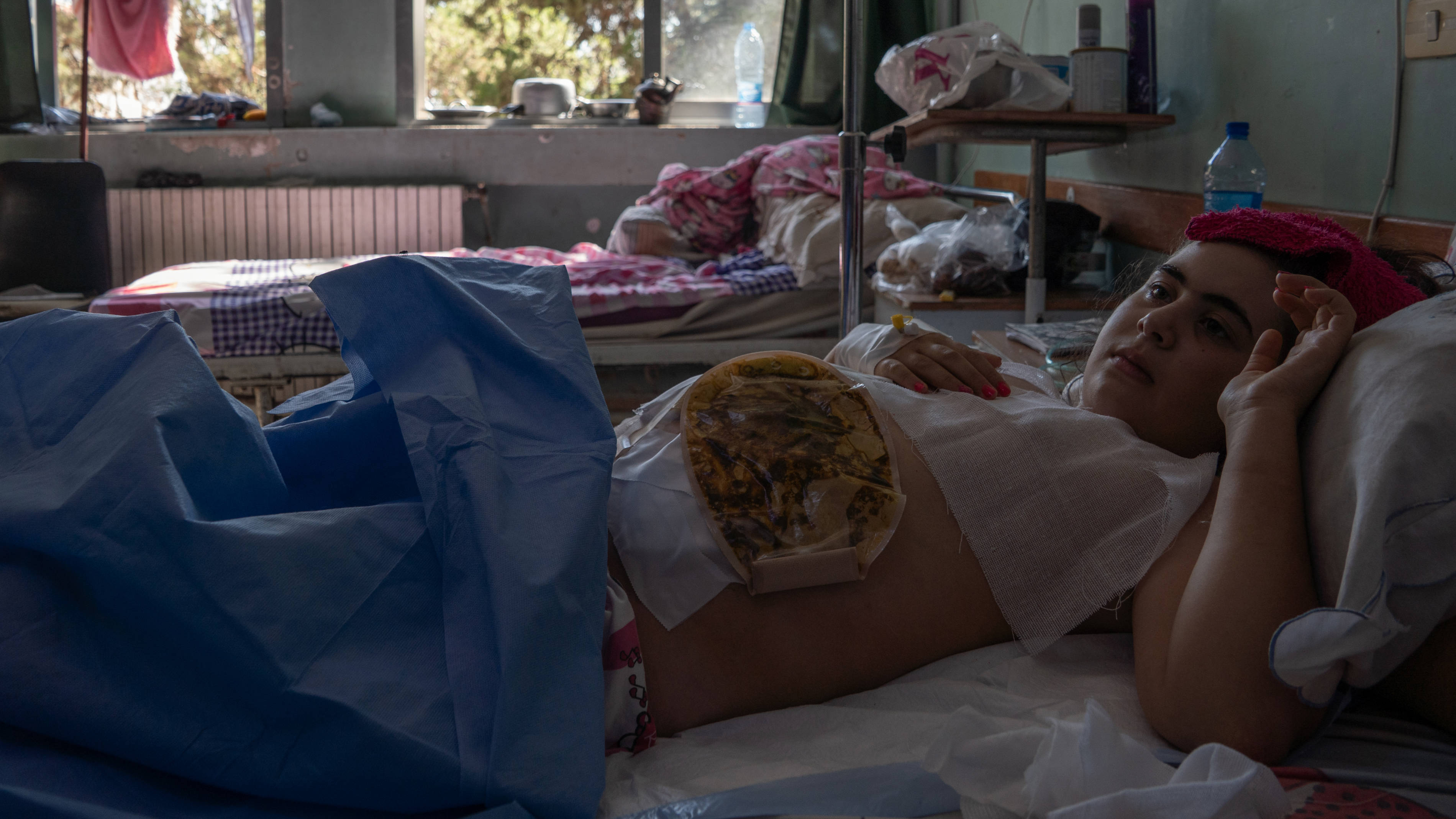 A wounded Druze girl lies in the Sweida National Hospital following attacks by armed men on her house in Sweida (Anagha Subhash Nair/MEE)