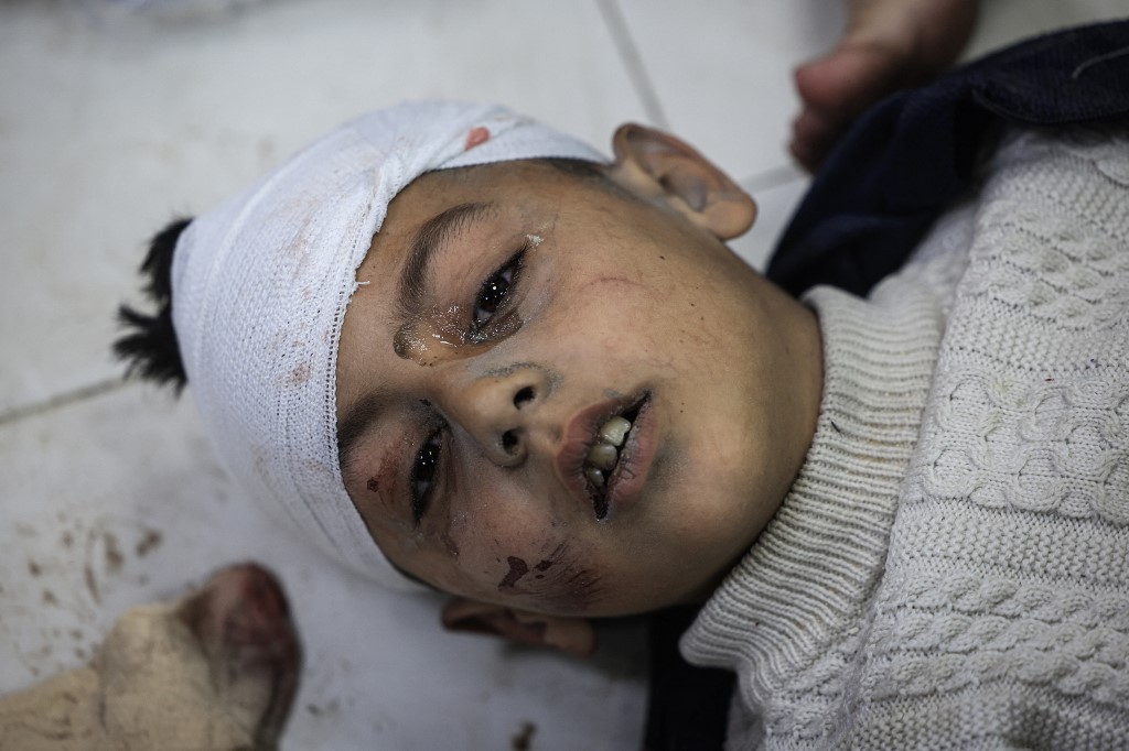 Firas al-Qedra, one of several relatives injured during Israeli bombardment that hit the Palestinian family's home, gets treatment at Nasser hospital in Khan Yunis in the southern Gaza Strip on December 16, 2023