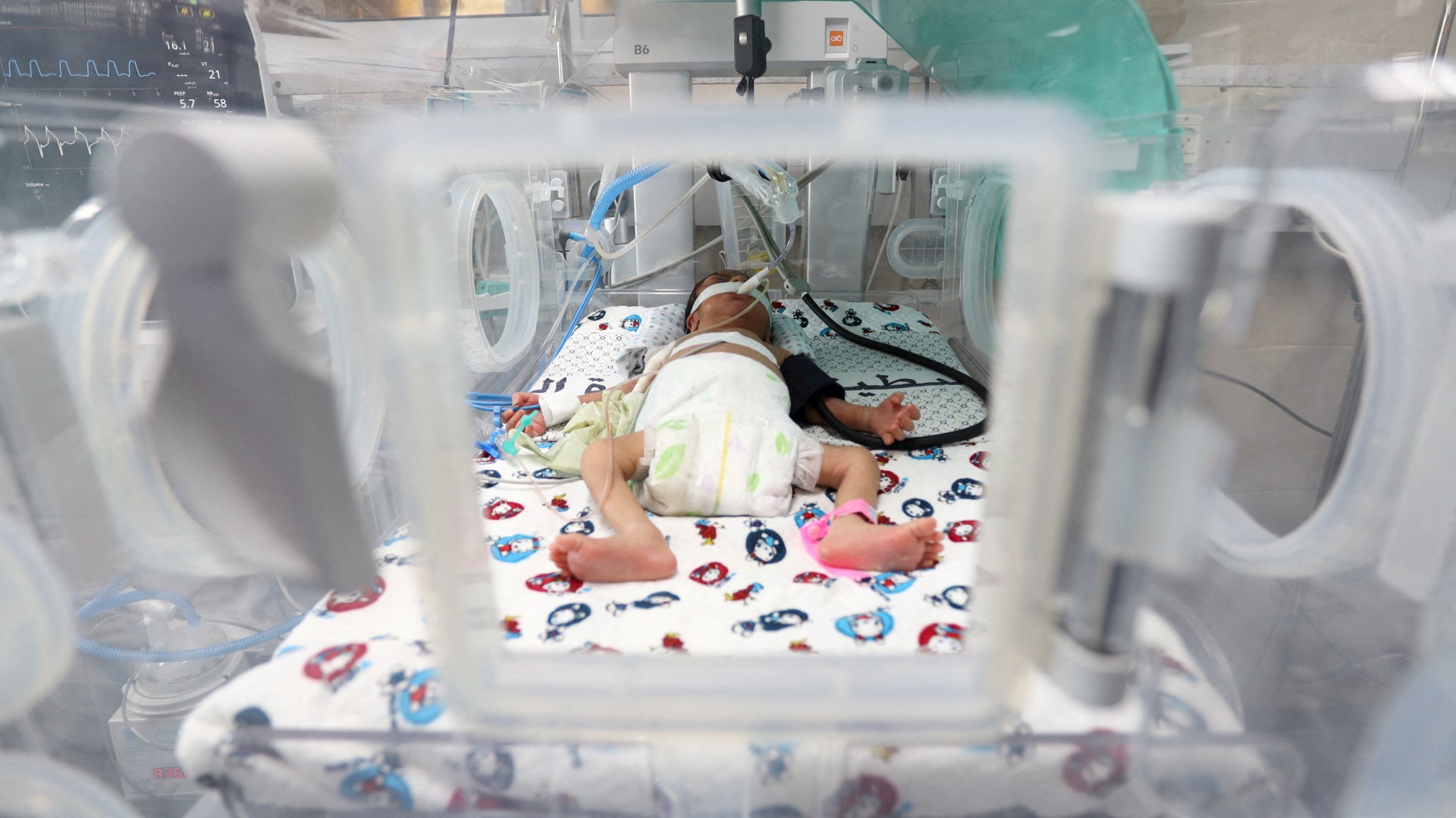 premature baby gaza city