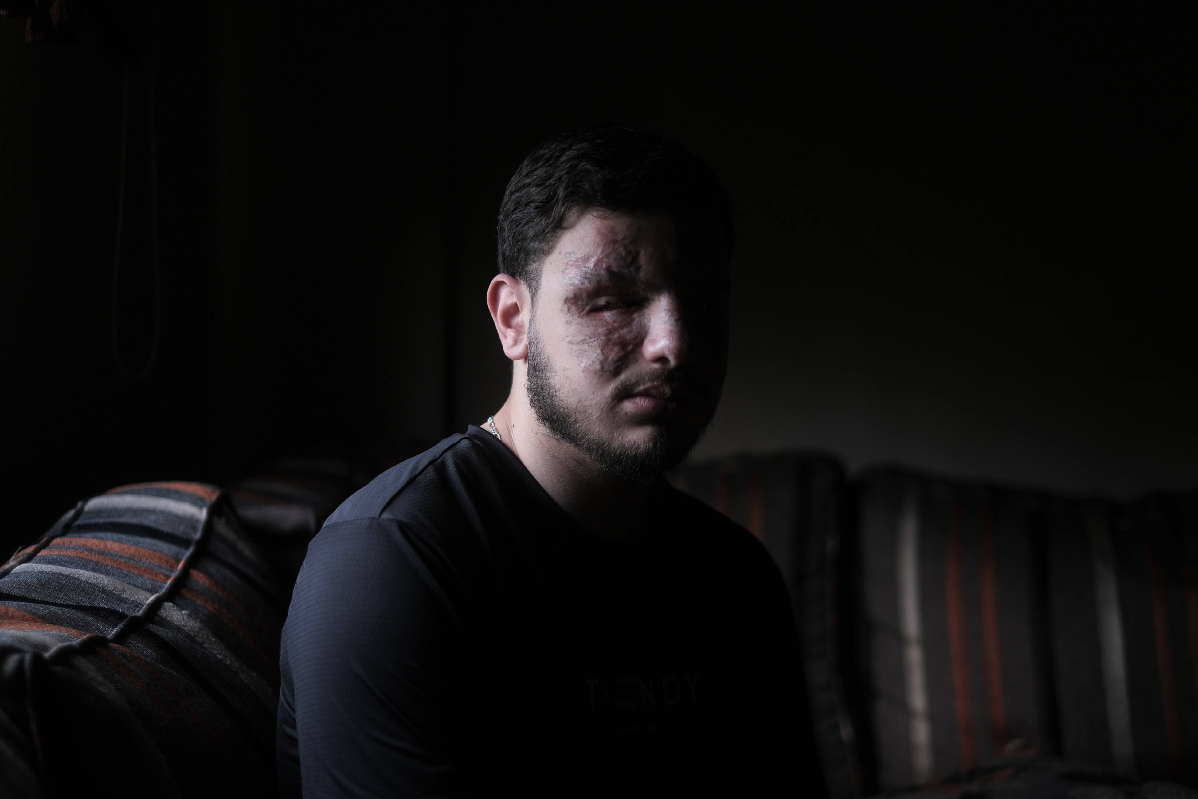 Hassan Bahsoun, 17, blinded by the pager attack, sits in his living room in Tayr Debba, Southern Lebanon (Joao Sousa/MEE)