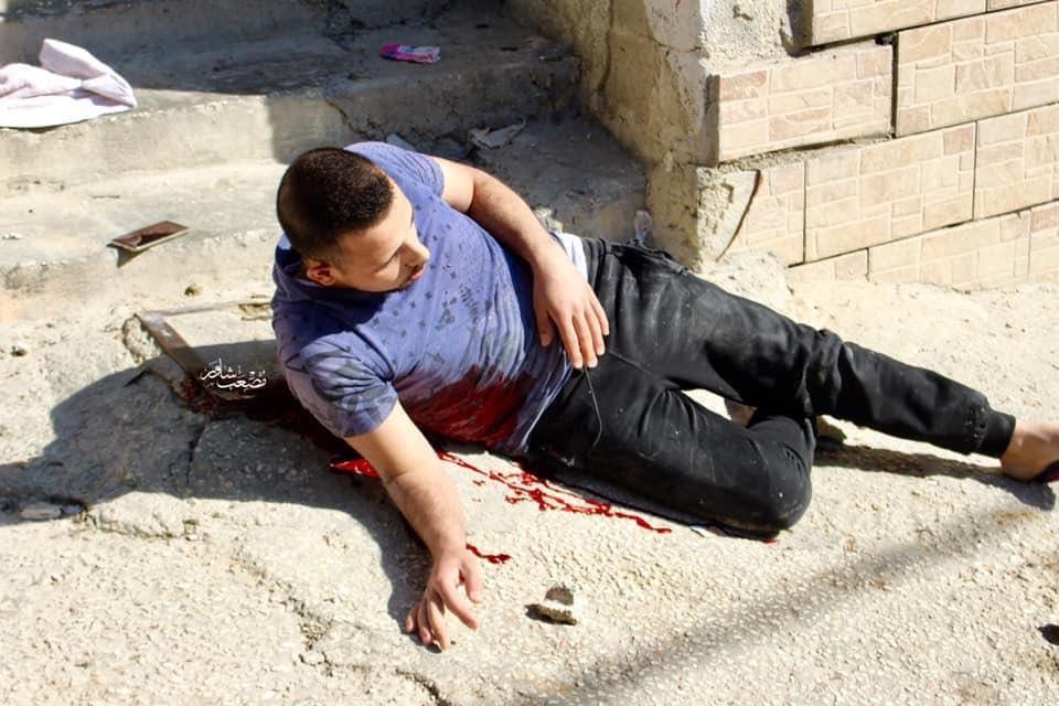A photo of Omar al-Badawi after he was reportedly shot in the abdomen by Israeli soldiers in al-Arroub refugee camp (Handout)