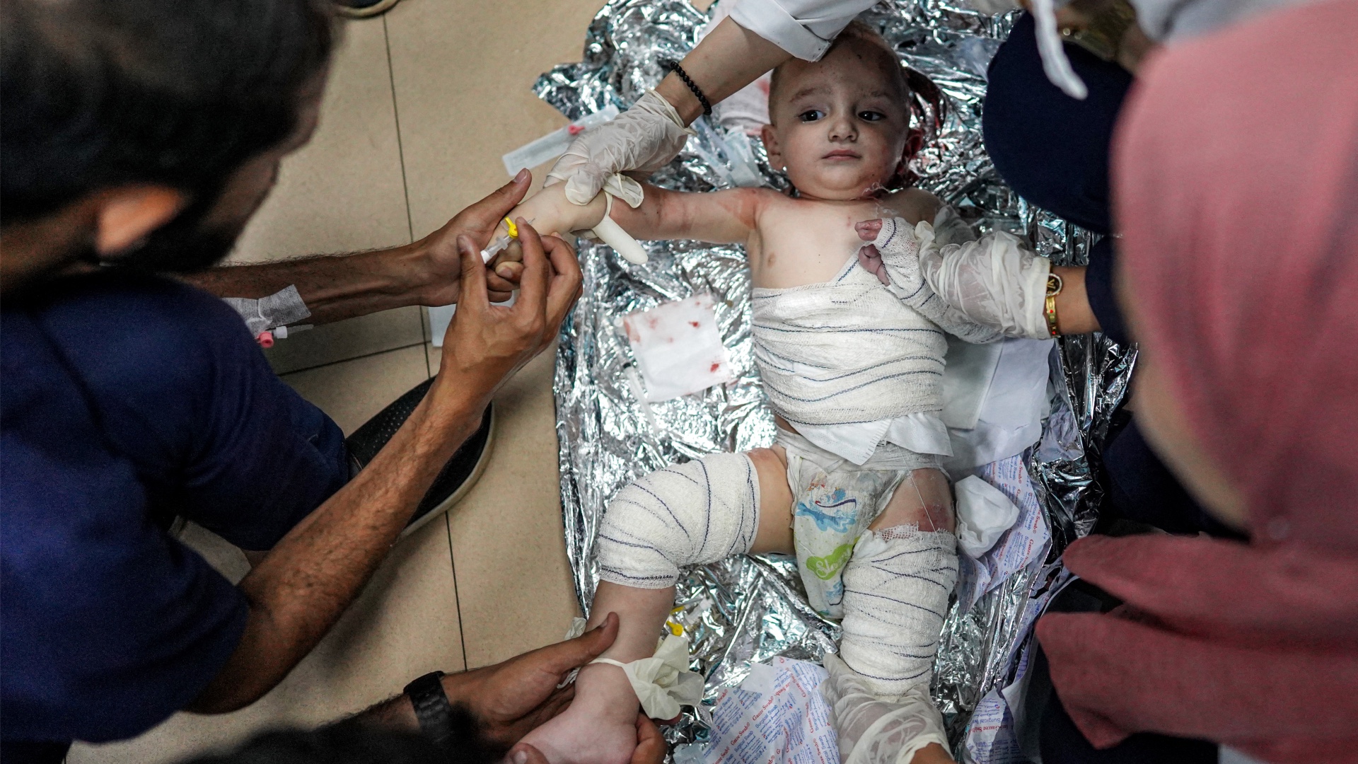Following Israeli bombardment on al-Bureij, medics tend to an injured infant child at a ward at Aqsa Martyrs hospital in Gaza's Deir el-Balah, on 4 June 2024 (Bashar Taleb/AFP)