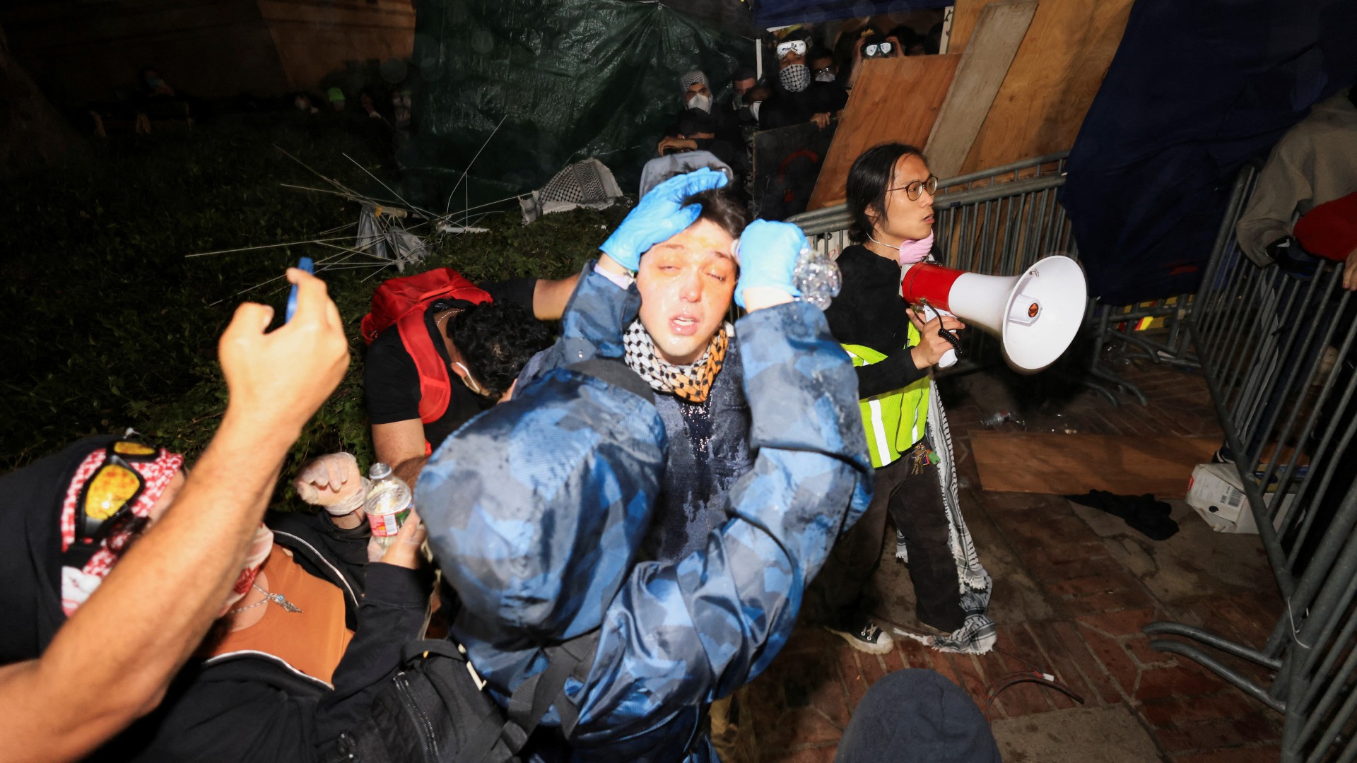 Pro-Palestine student receives medical attention after Israel supporters attack student encampment at UCLA on 01 May, 2024 (Reuters)