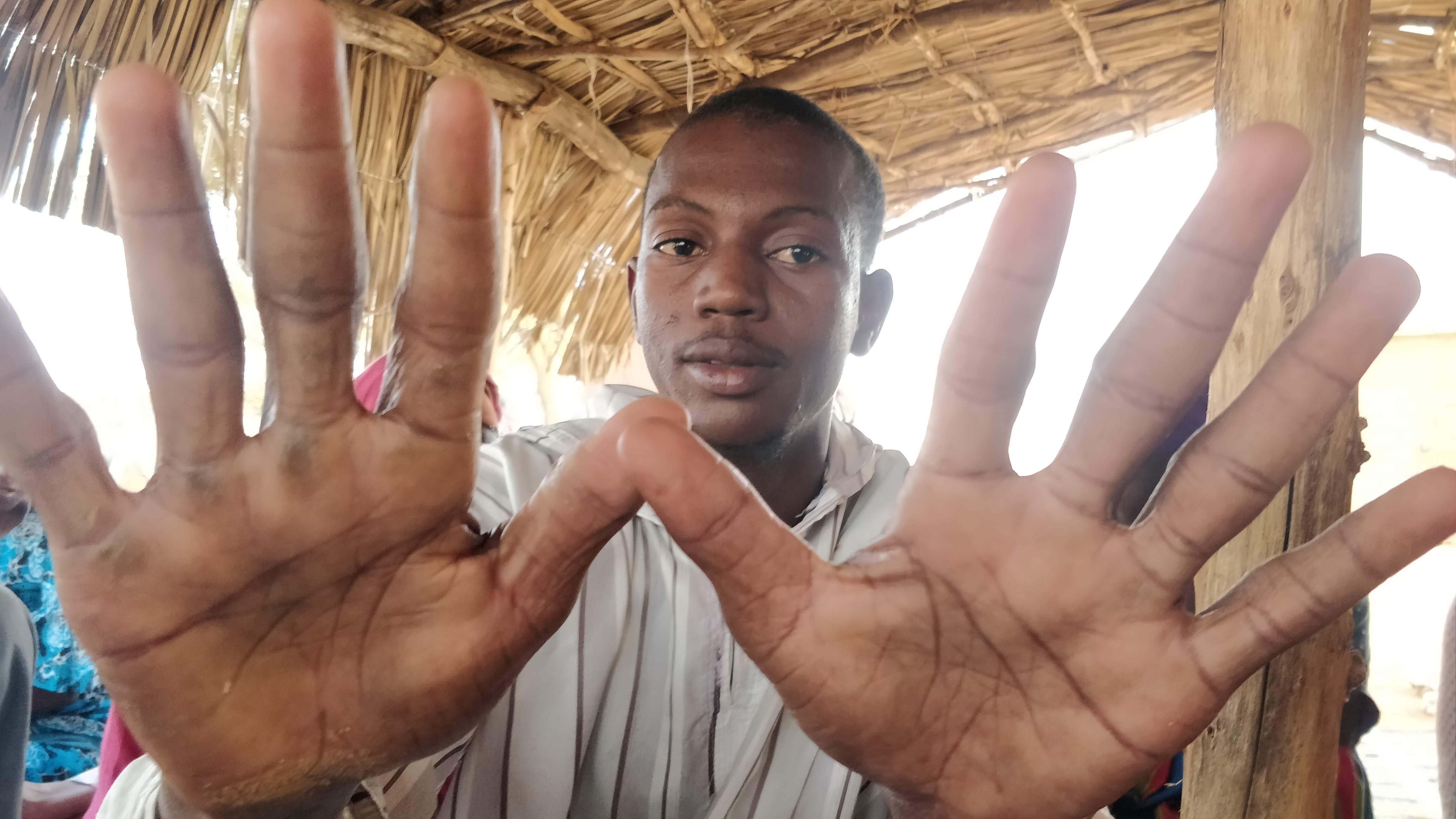 Abou Diop's has calloused palms from the wood chopping he does to make ends meet (MEE/Amandla Thomas-Johnson)