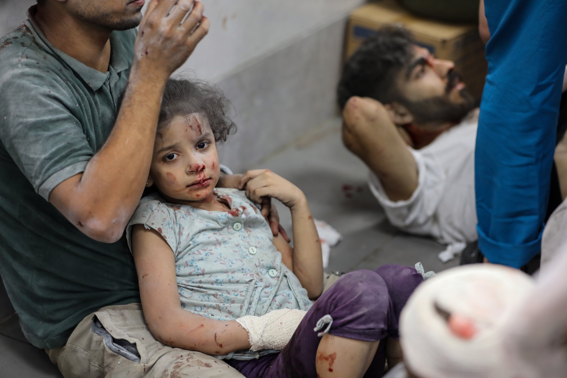 injured girl al shifa hospital