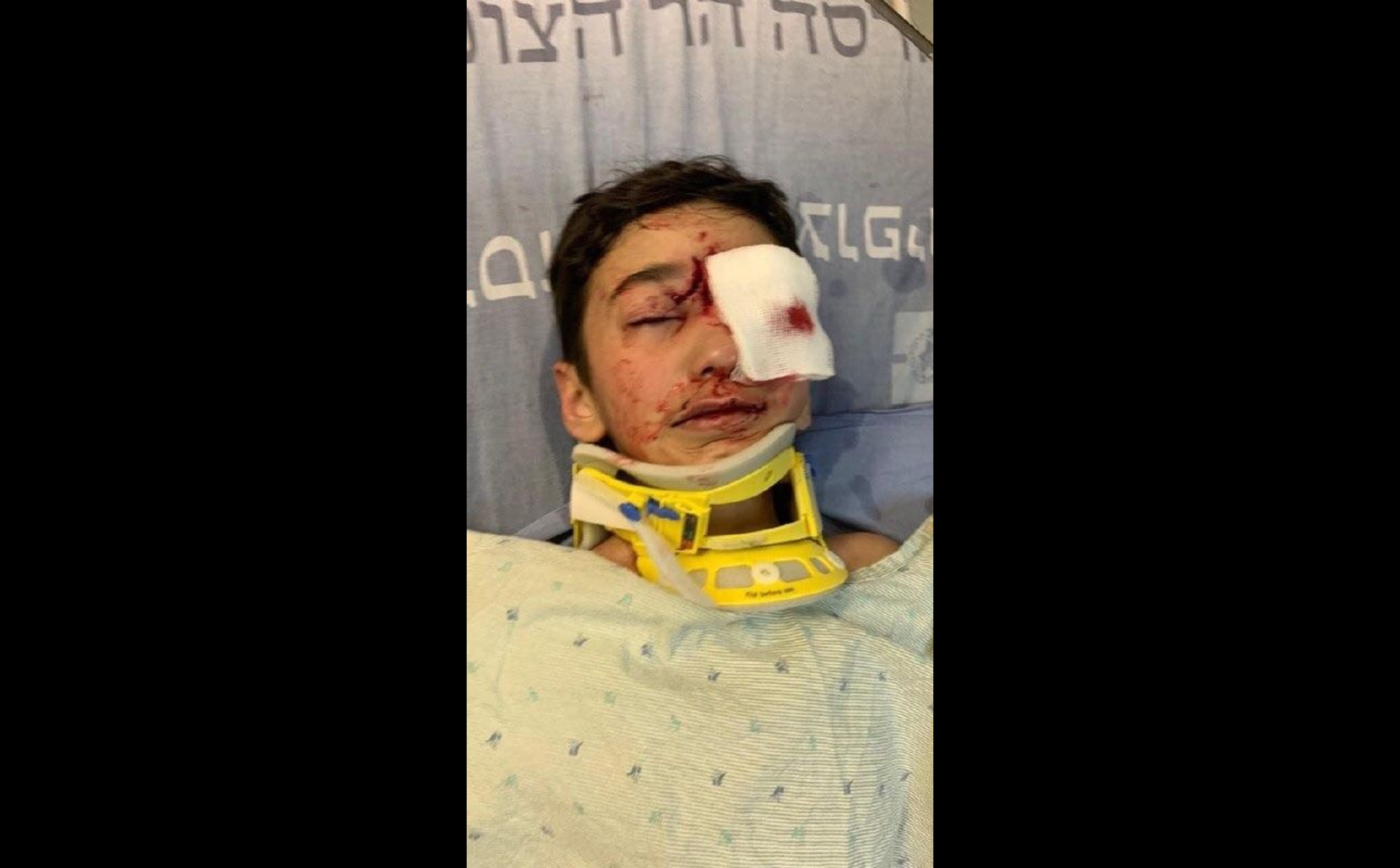 Malek souffre de fractures du crâne et du visage ainsi que d’une hémorragie cérébrale (réseaux sociaux)