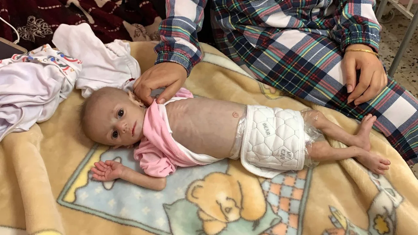 Suwar Ashour, who weighs just 2.9 kg at five months, has gained less than half a kilogram since she was born (MEE/Ahmed Aziz)