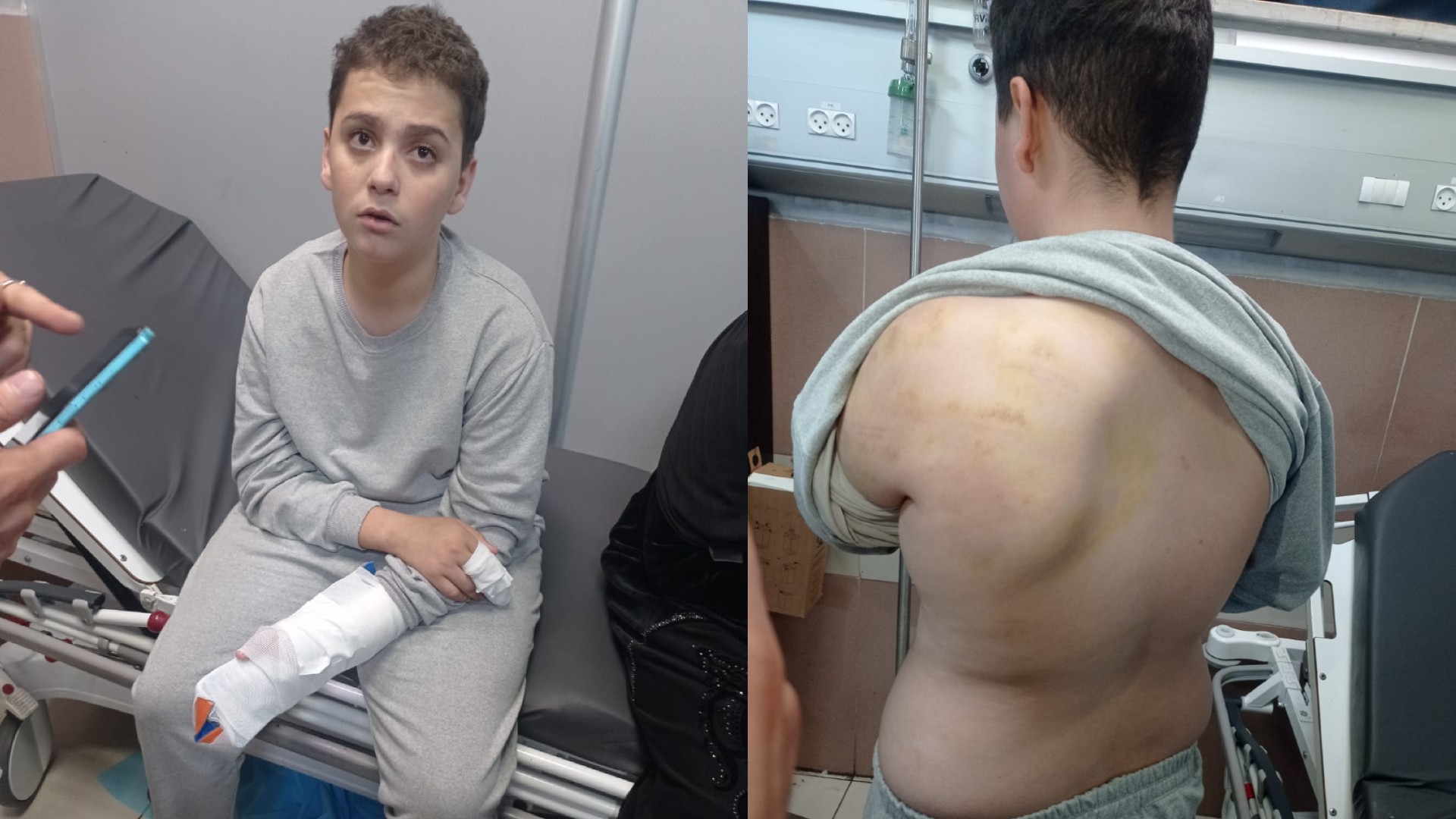 Muhammad Nazzal, 17, pictured in hospital with a case in his hand for broken fingers and bruises on his back (Provided)