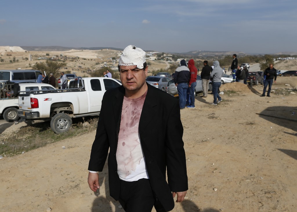 Politician Ayman Odeh was shot and wounded in Umm al-Hiran in January 2017 (AFP)