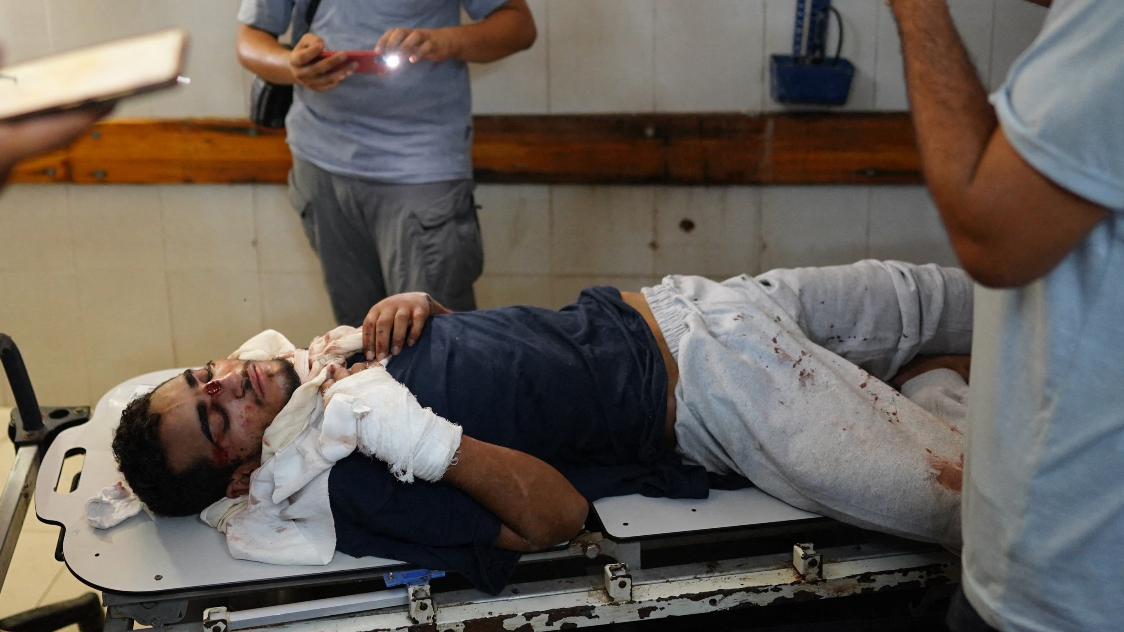 Palestinian man Faouzi Abdel Aal, 21, receiving treatment for his injuries at the Nasser hospital in Khan Younis, south Gaza, after release from Israeli detainment (AFP/Bashar Taleb)