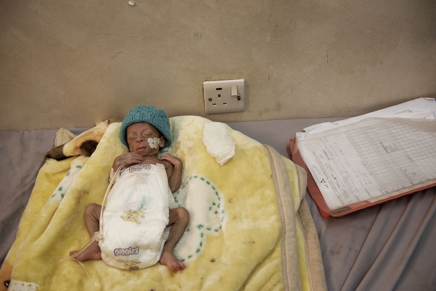 A premature baby in a Doctors Without Borders (MSF) hospital in Saada in September 2019 (Alessio Romenzi/MEE)