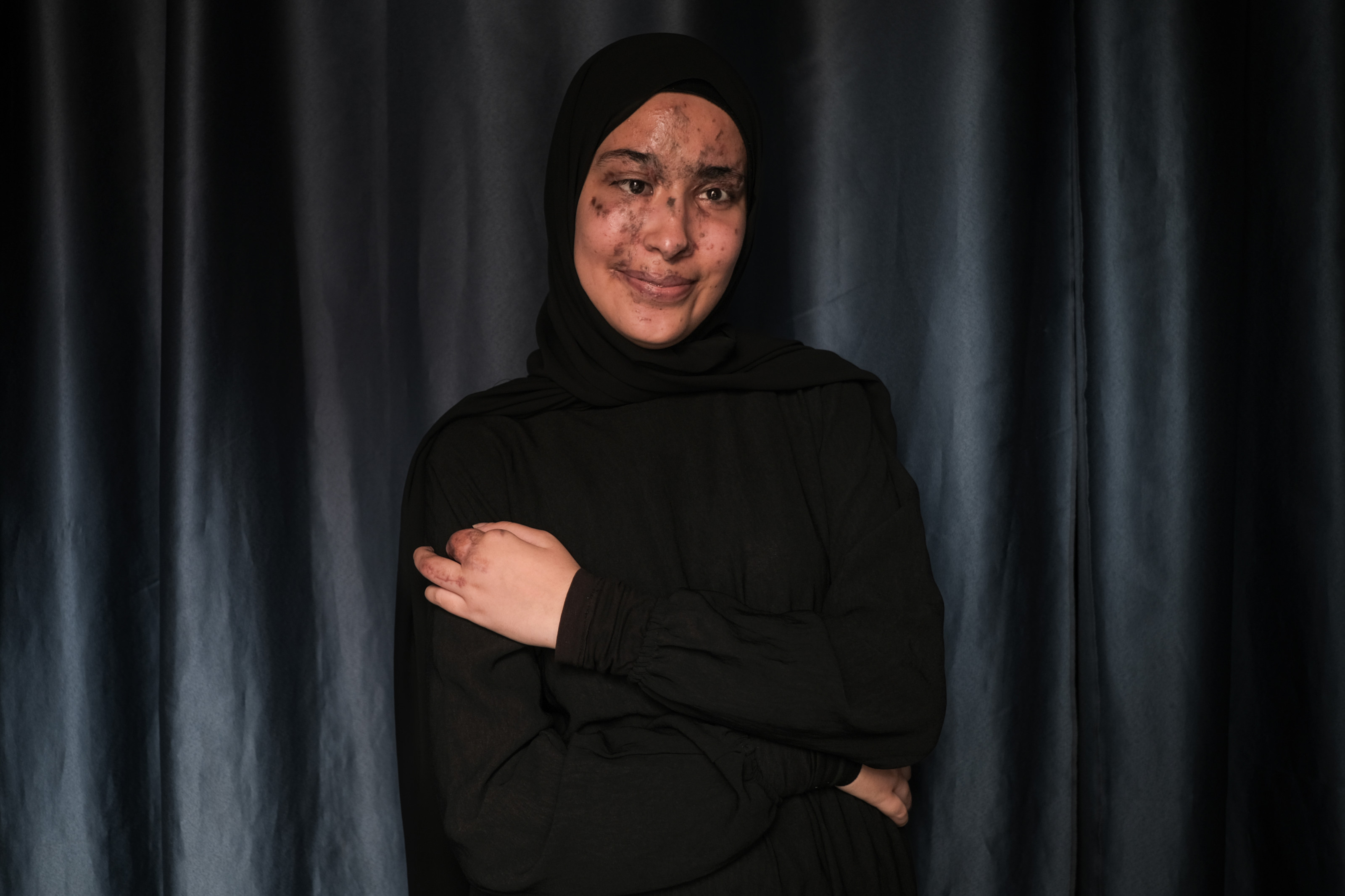 Portrait of Sarah Jaffal, one of thousands of Lebanese civilians wounded by the pager attacks (João Sousa/MEE)