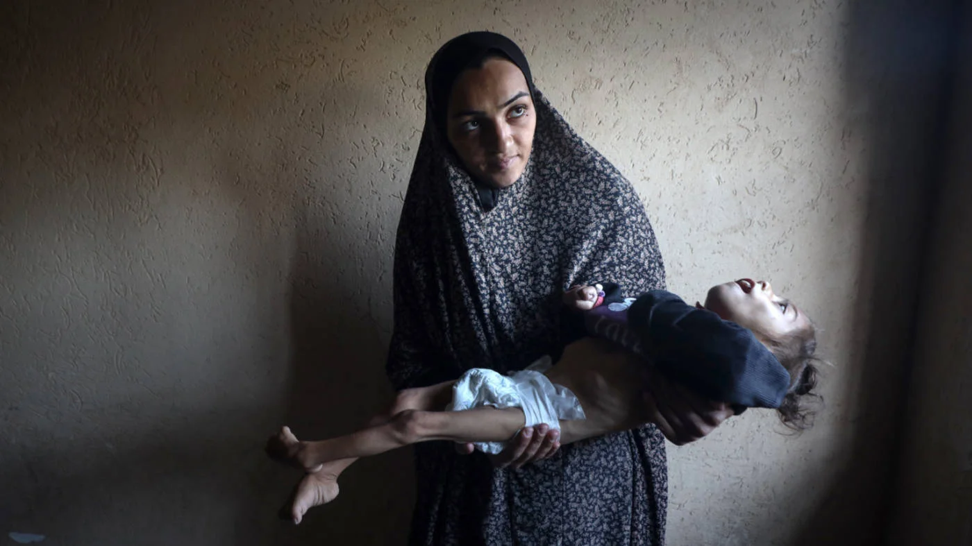 A Palestinian mother changes the clothes of her five-year-old daughter, who suffers from malnutrition, in Deir el-Balah, Gaza, on 24  December 2024 (AFP)