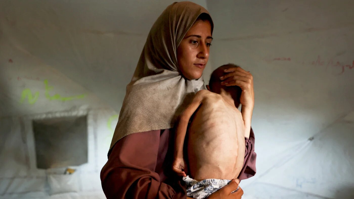 Hidaya, 31, a Palestinian mother carries her sick 18-month-old son Mohammed al-Mutawaq, who is also displaying signs of malnutrition, inside their tent at the al-Shati refugee camp, west of Gaza City, on 24 July 2025 (AFP/Omar al-Qattaa)