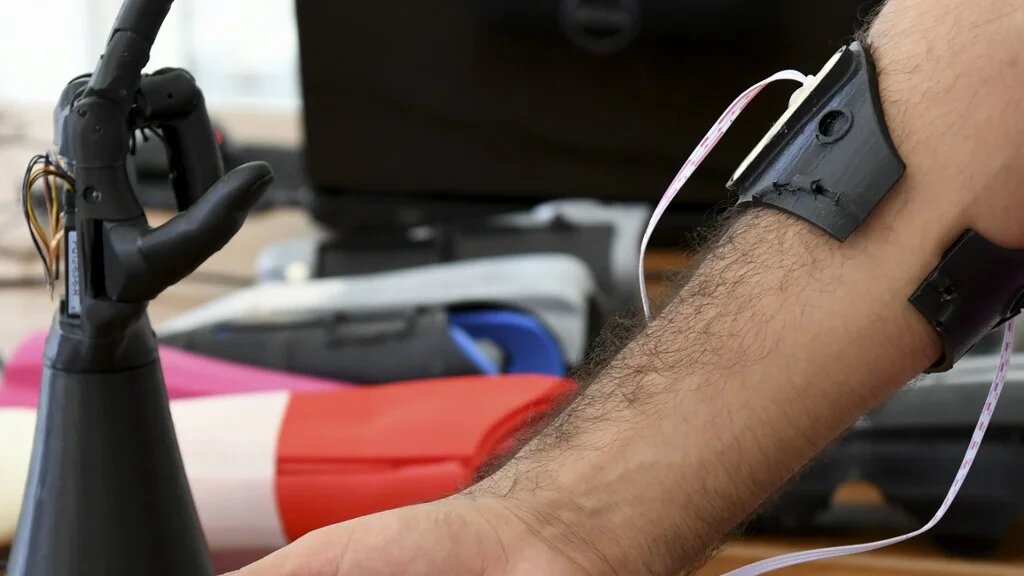 La main de Cure Bionics se compose d’éléments emboîtés, ce qui permet de remplacer facilement un élément endommagé (AFP)