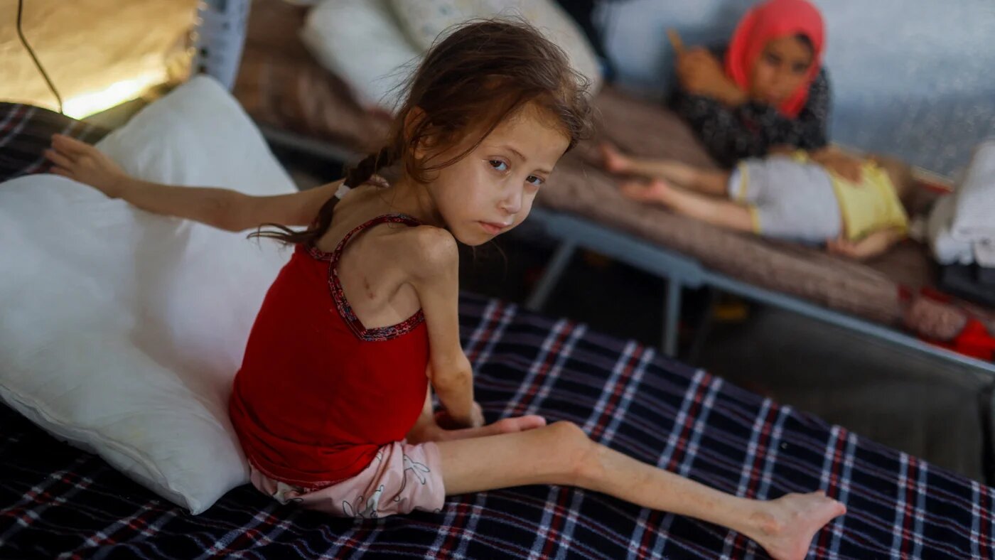 Jana Ayad, a malnourished Palestinian girl, rests on a bed as she receives treatment at the International Medical Corps field hospital in Deir al-Balah in the southern Gaza Strip, 22 June 2024 (Reuters/Mohammed Salem)
