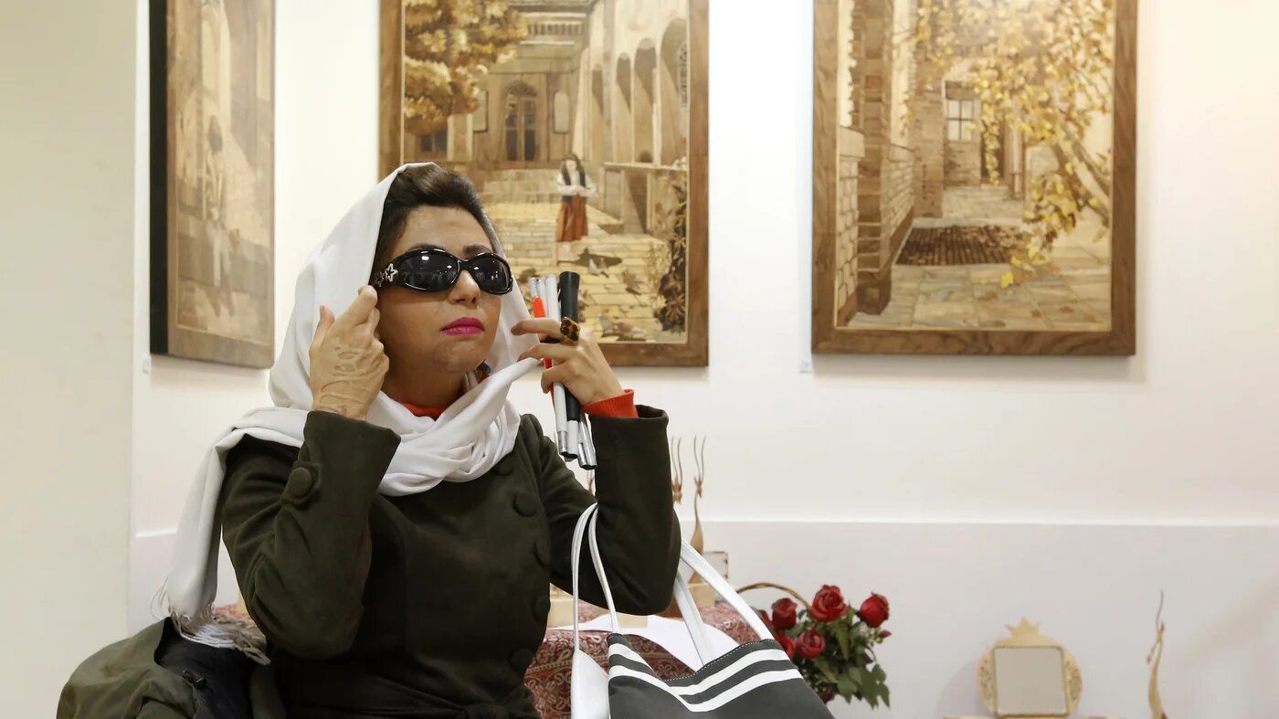 Iran acid attack victim AFP