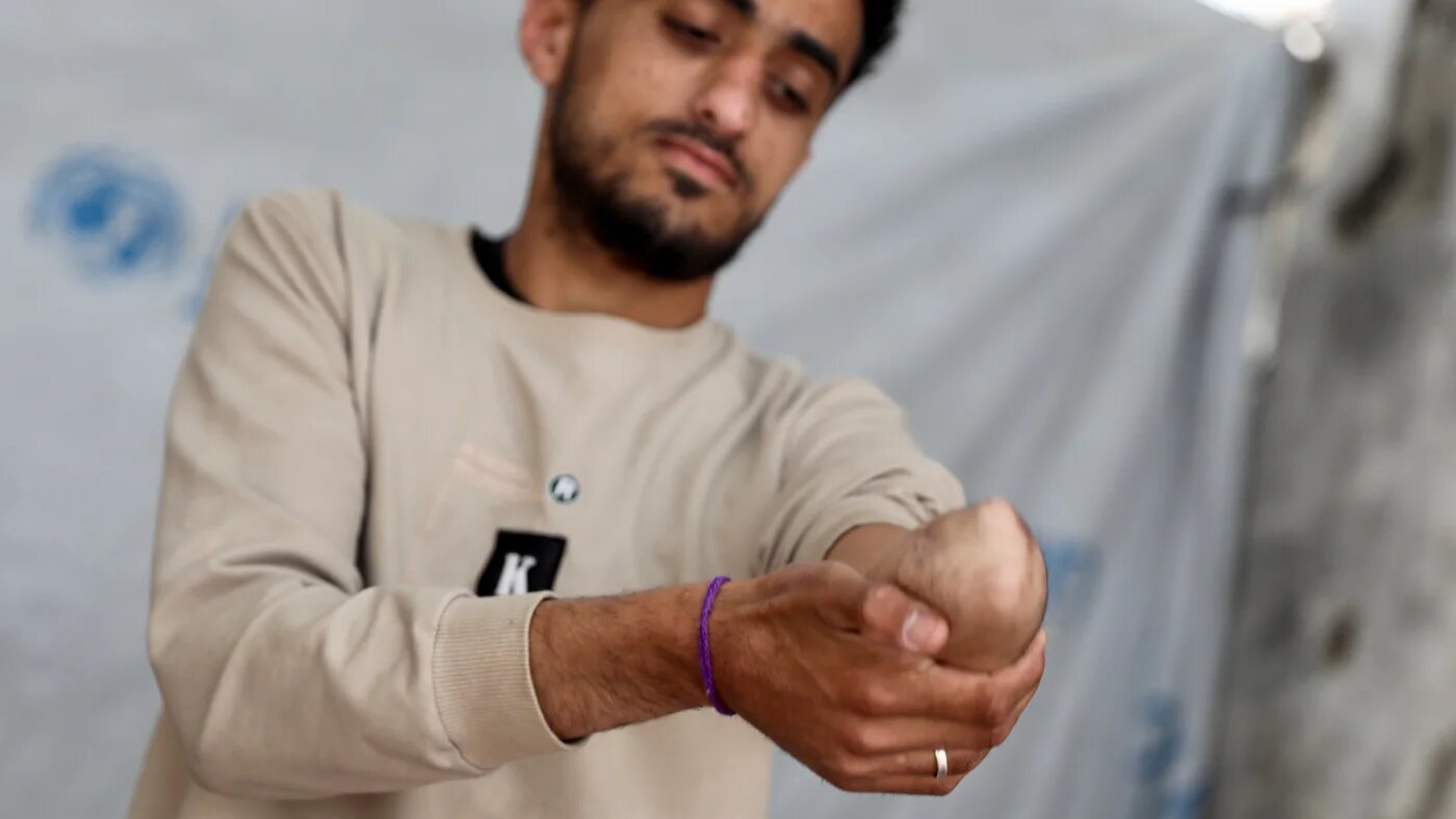 Tens of thousands in Gaza, including Abdelsalam al-Bardawil,  sustained life-altering injuries in Israeli strikes and now struggle to access prosthetics and rehabilitation (Mohammed al-Hajjar/MEE)