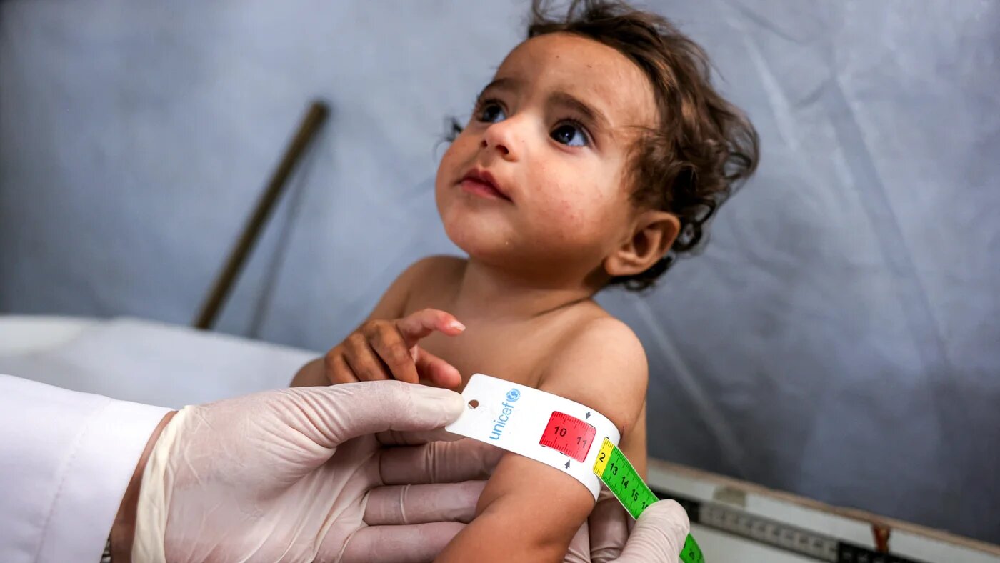 Nujud Suleiman, a Palestinian infant suffering from malnutrition, receives treatment at the Kamal Adwan Hospital in Beit Lahia north Gaza, 24 April, 2025 (AFP/Bashar Taleb)