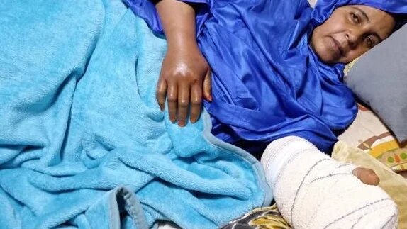 Zainabu Babi a eu les mains cassées après un interrogatoire dans un poste de police marocain (photo fournie)