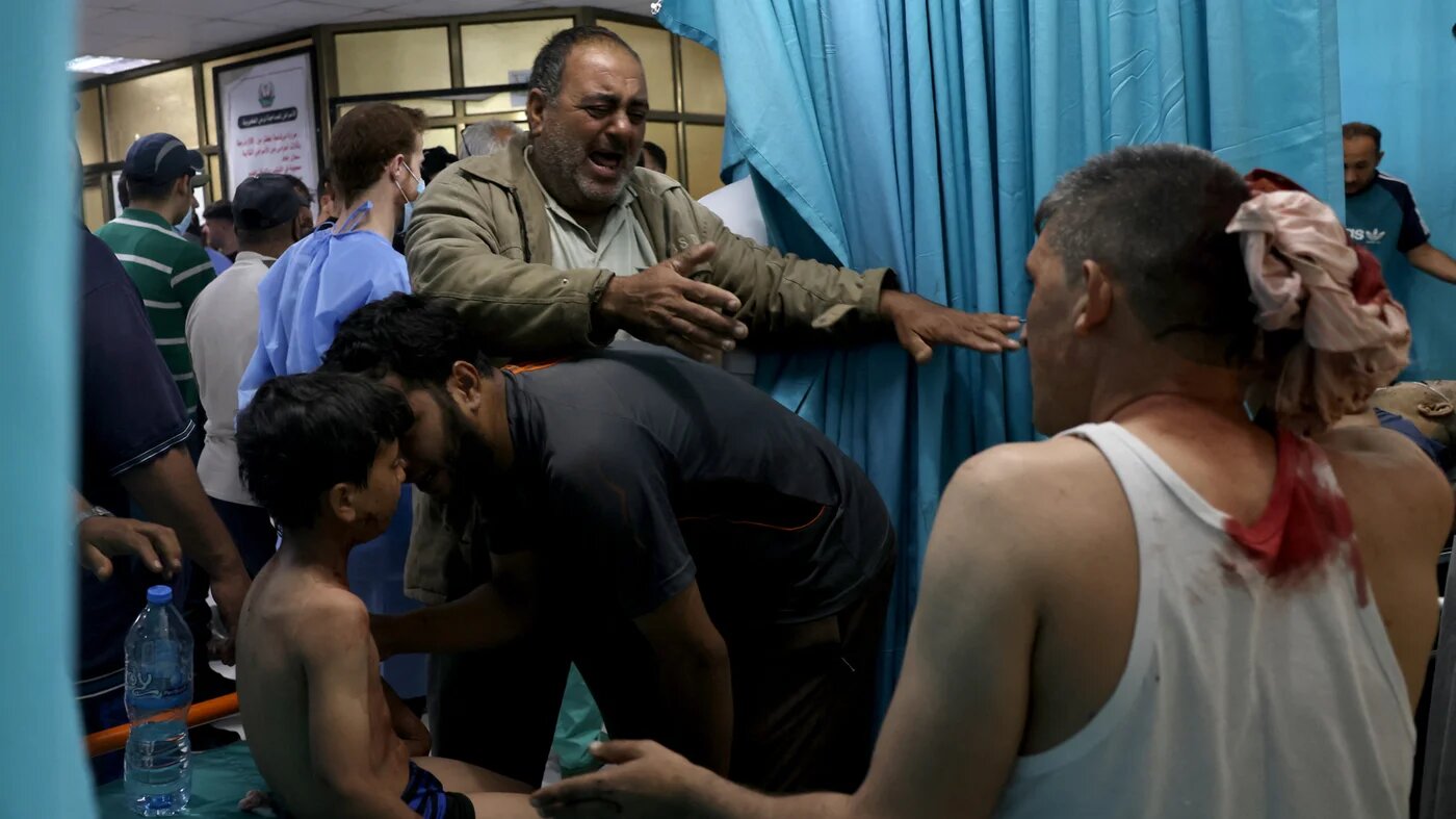 Wounded Palestinians being treated at a hospital in the northern Gaza Strip following Israeli air strikes