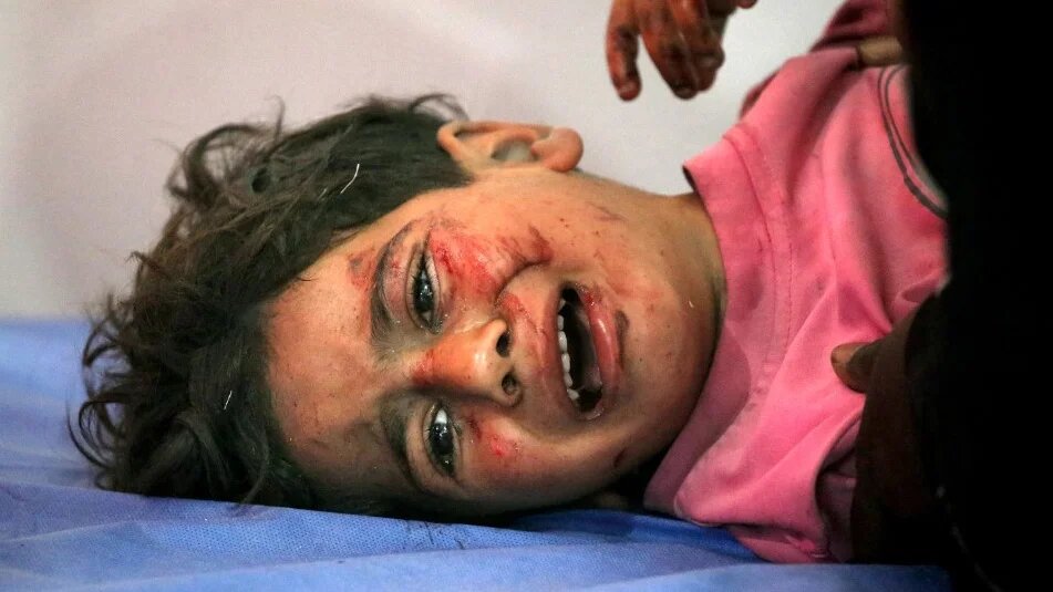 An injured child cries while receiving medical care at a hospital in the Nuseirat refugee camp in central Gaza, after an Israeli strike, on 29 May 2025 (Eyad Baba/AFP)