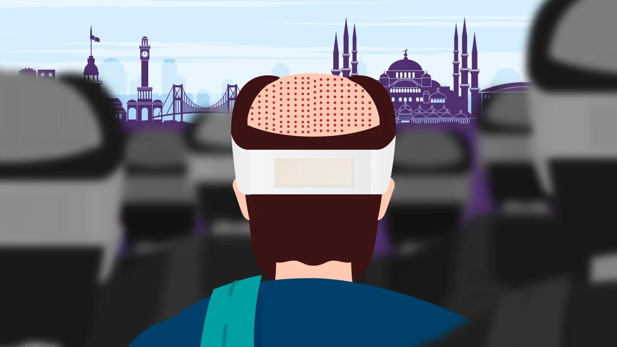Patients are drawn to Turkey for procedures like hair transplants due to cheap prices and the speed of procedures (Illustration/MEE)