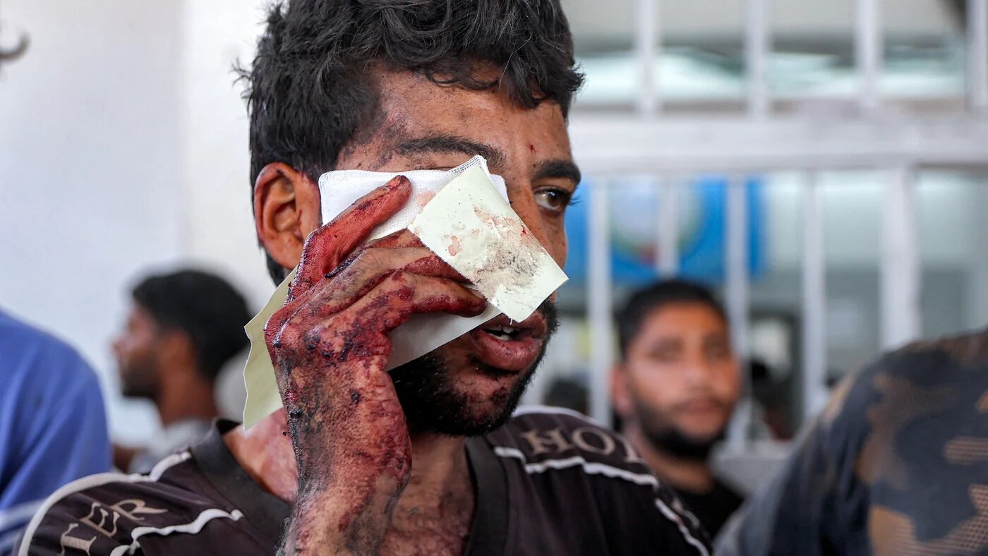 A wounded Palestinian man holds a bandage to his face following Israeli attacks on aid seekers in al-Sudaniya, an area in northwestern Gaza, on 14 June 2025 (AFP/Omar al-Qattaa)