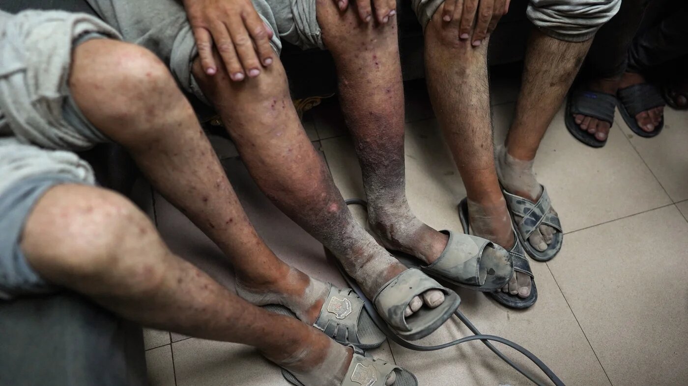 Former Palestinian detainees arrive after their release for a check up at the Al-Aqsa Martyrs Hospital in Deir el-Balah in the central Gaza Strip on 1 July, 2024 (AFP/Bashar Taleb)