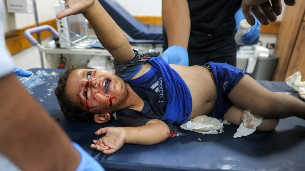 An injured child is treated in Khan Younis, Gaza, on 24 June 2026 (Bashar Taleb/AFP)