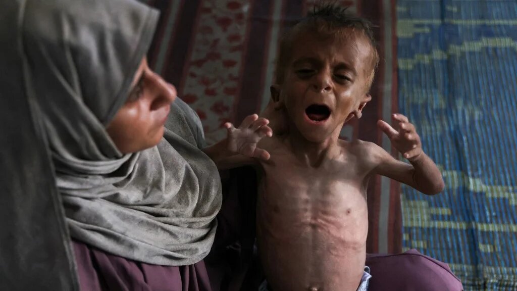A Palestinian mother cradles her 18-month-old son, displaying signs of malnutrition, in Gaza’s al-Shati refugee camp, on 24 July 2025 (Omar al-Qattaa/AFP)