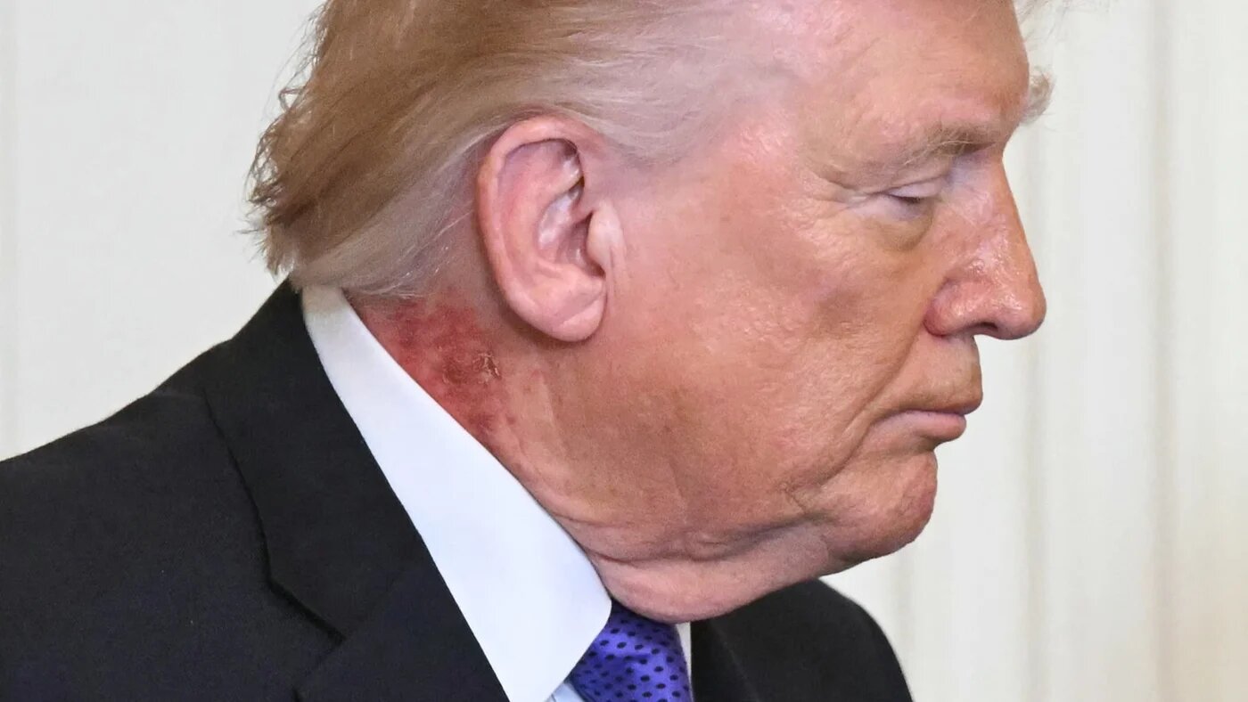 US President Donald Trump attends the Medal of Honor ceremony in the White House on 2 March, 2026, in Washington, DC (AFP/Saul Loeb)