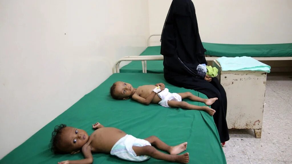 Une femme est assise à côté d’un enfant souffrant de malnutrition, dans un centre de traitement de la malnutrition, dans le village de Hays, dans la province occidentale de Hodeida, ravagée par la guerre au Yémen, le 11 juin 2022 (AFP/Khaled Ziad)