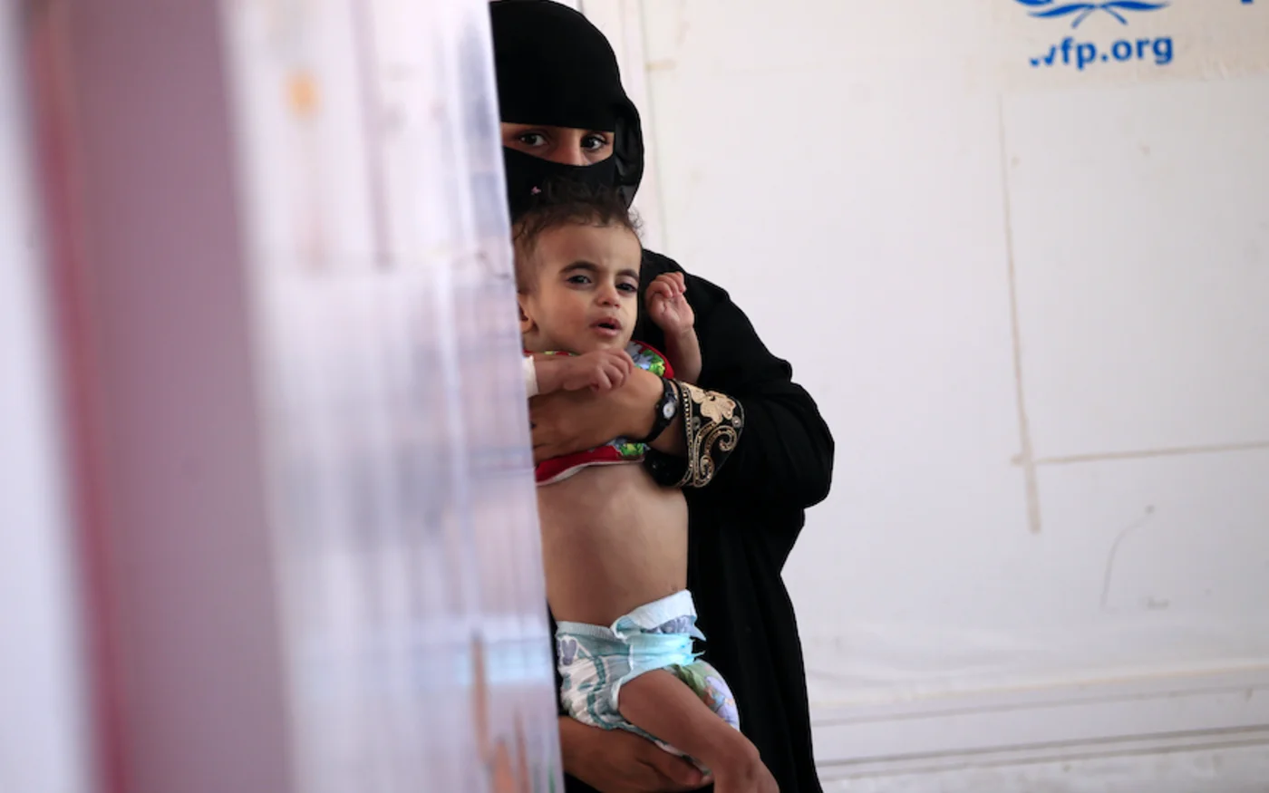 Une femme tient dans ses bras un enfant, à l'hôpital Al-Sabeen, à  Sanaa, le 23 novembre 2019 (AFP)