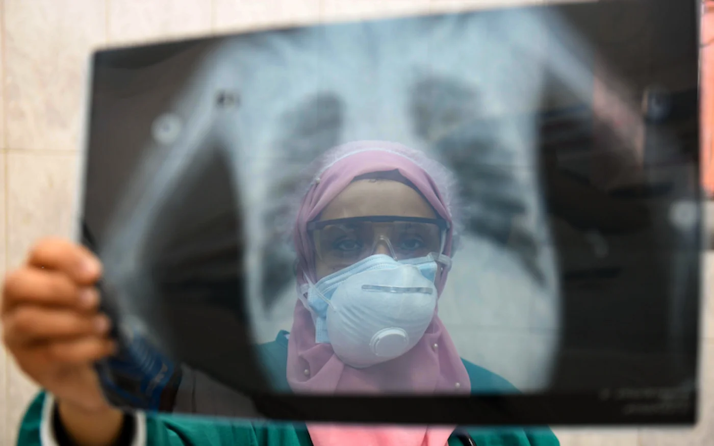 Une médecin vérifie la radiographie pulmonaire d'un patient à l'unité des maladies infectieuses de l'hôpital d'Imbaba, au Caire, le 19 avril 2020 (AFP)
