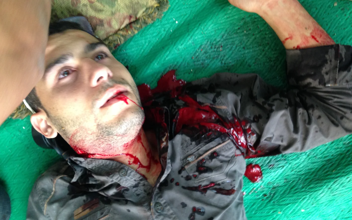 Protester shot in the neck needing medical care