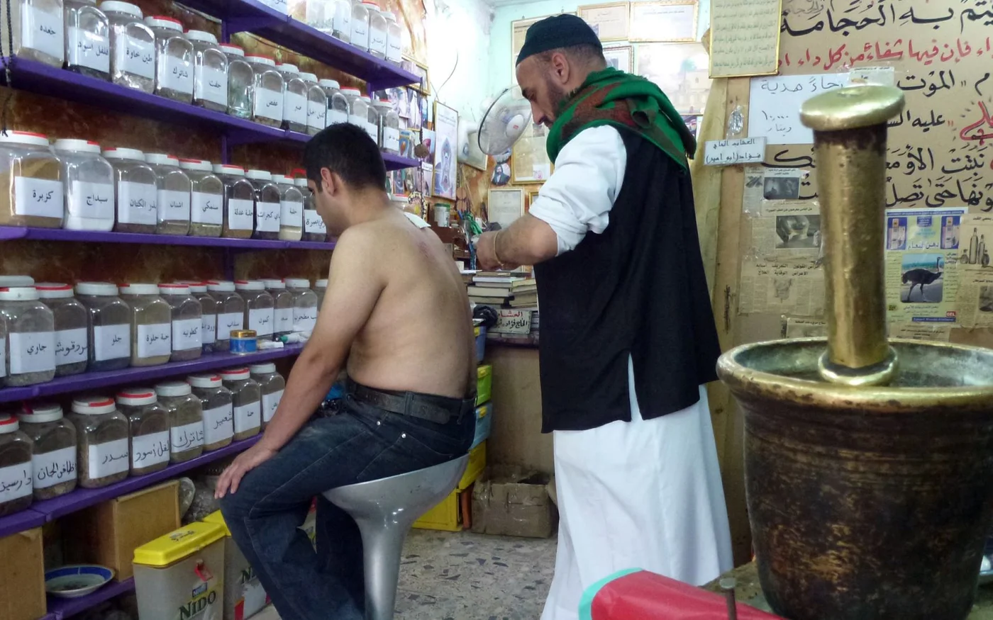 Un homme subit un soin par ventouses dans la capitale irakienne Bagdad (AFP/Sabah Arar)