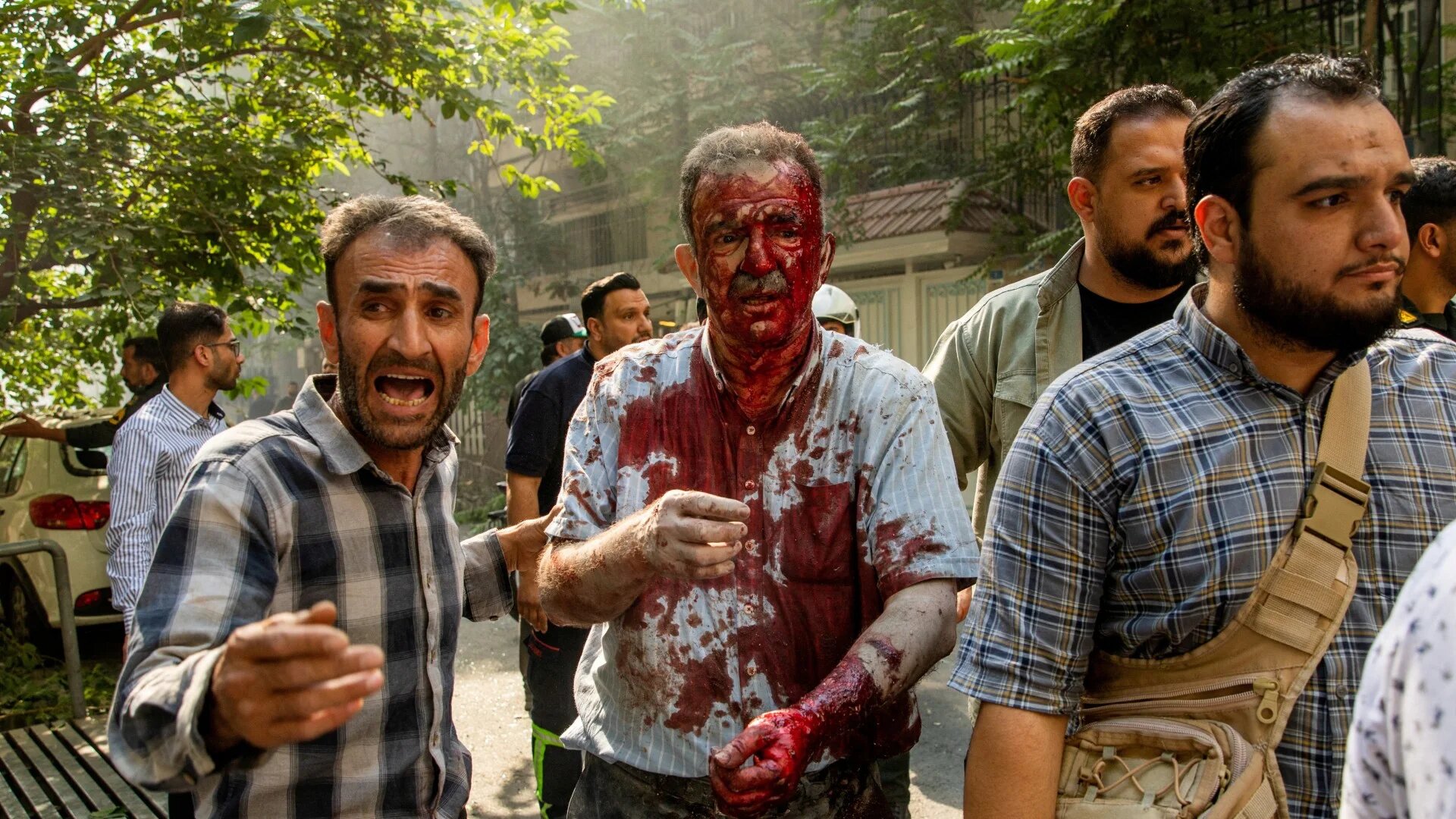 Iranians care for a man who was injured in an Israeli strike on Keshavarz Boulevard in downtown Tehran on 15 June 2025 (Majid Khahi/AFP)