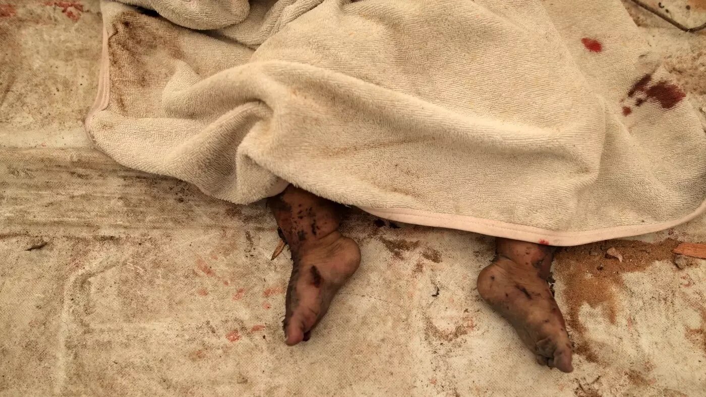 Des Palestiniens déplacés s’étaient réfugiés dans la cour de l’hôpital al-Ahli en pendant avoir trouvé un endroit sûr. Beaucoup d’entre eux sont aujourd’hui morts ou grièvement blessés (MEE/Muhammad Zanon)